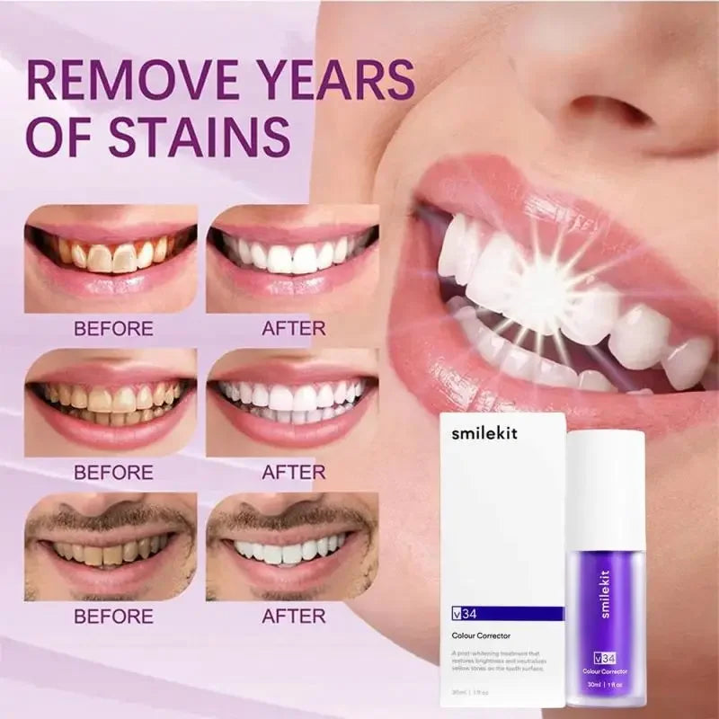 🔥30ml V34 SmileKit Purple Toothpaste Removes Tartar Clean Oral Hygiene Fresh Breath Whitening Teeth Care Products